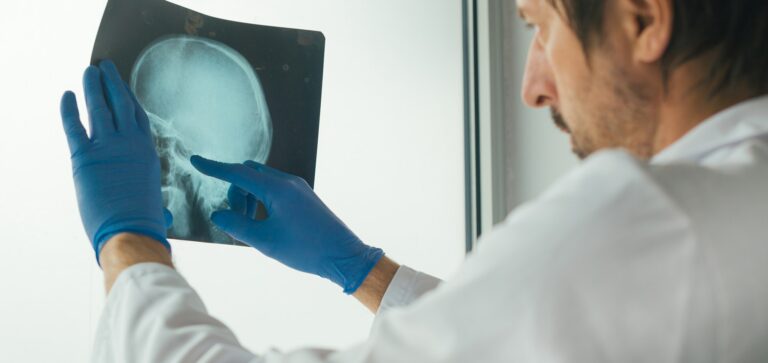 Doctor examining x-ray of the skull